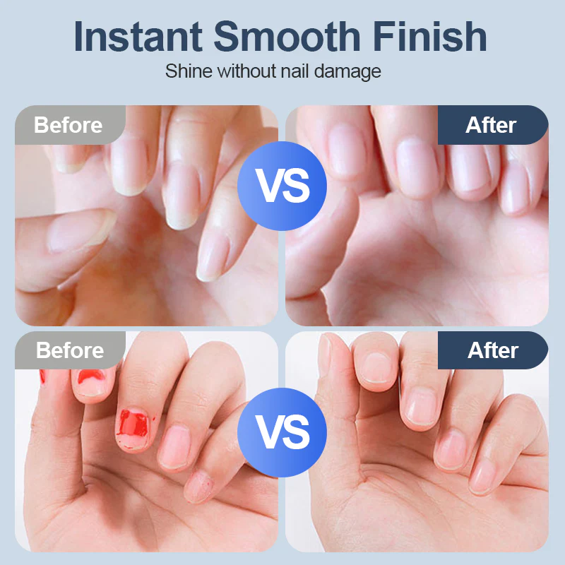 🔥 50% DE RÉDUCTION ! ✨ Ponceuse à Ongles Auto - 3 Vitesses Réglables, Silencieuse, LED Integrée pour Soin Précise ✨ -Remifa® - Image 3